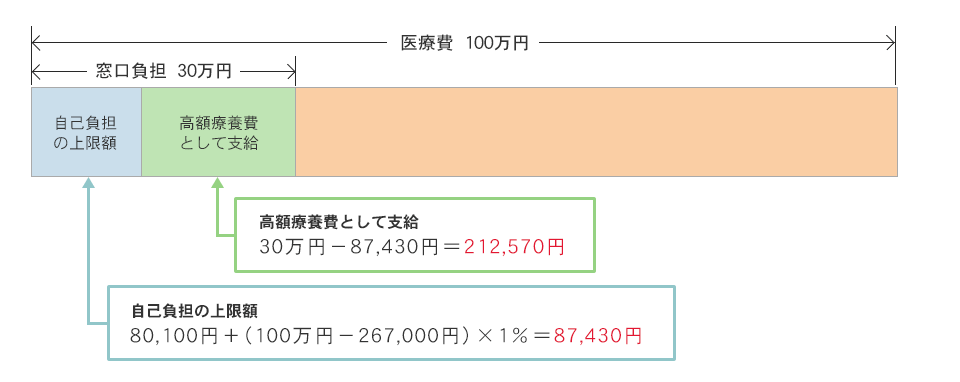 高額療養費制度（計算例：69歳以下・年収370万～770万円まで）